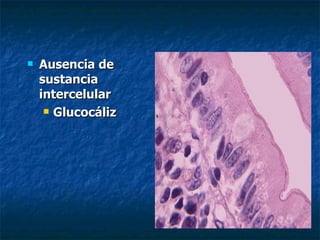    Ausencia de
    sustancia
    intercelular
      Glucocáliz
 