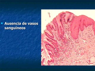    Ausencia de vasos
    sanguíneos
 