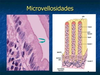 Microvellosidades
 