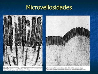 Microvellosidades
 