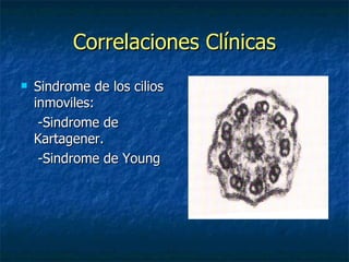 Correlaciones Clínicas
   Sindrome de los cilios
    inmoviles:
     -Sindrome de
    Kartagener.
     -Sindrome de Young
 