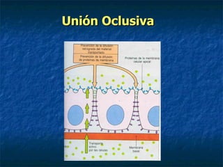 Unión Oclusiva
 