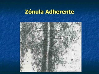 Zónula Adherente
 