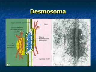 Desmosoma
 