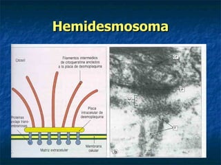 Hemidesmosoma
 