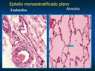 Epitelio monoestratificado plano
Endotelios                    Alveolos
 