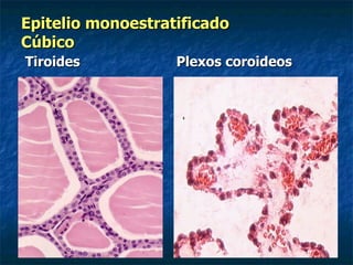 Epitelio monoestratificado
Cúbico
Tiroides           Plexos coroideos
 