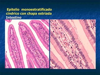 Epitelio monoestratificado
cíndrico con chapa estriada
Intestino
 
