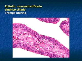 Epitelio monoestratificado
cíndrico ciliado
Trompa uterina
 