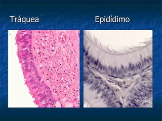 Tráquea   Epidídimo
 