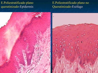E.Poliestratificado plano   E.Poliestratificado plano no
queratinizado-Epidermis     Queratinizado-Esófago
 
