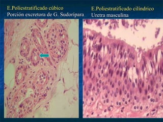 E.Poliestratificado cúbico           E.Poliestratificado cilíndrico
Porción excretora de G. Sudorípara   Uretra masculina
 