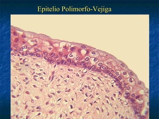 Epitelio Polimorfo-Vejiga
 