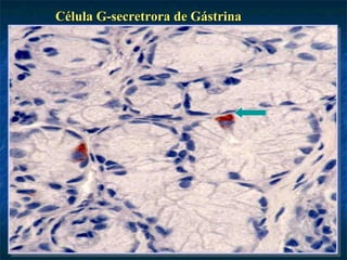 Célula G-secretrora de Gástrina
 