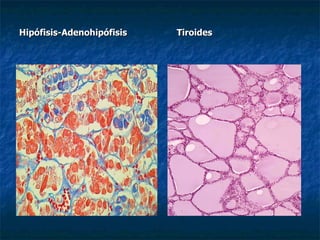 Hipófisis-Adenohipófisis   Tiroides
 