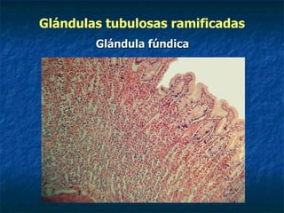 Glándulas tubulosas ramificadas
        Glándula fúndica
 