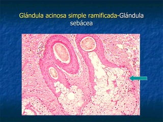 Glándula acinosa simple ramificada-Glándula
                  sebácea
 