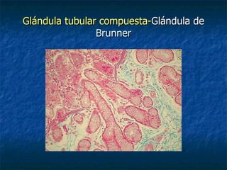 Glándula tubular compuesta-Glándula de
                Brunner
 