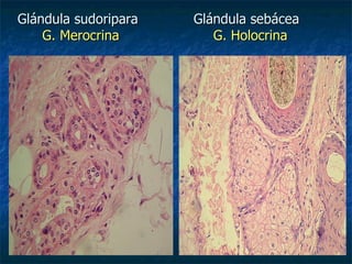 Glándula sudoripara   Glándula sebácea
    G. Merocrina         G. Holocrina
 