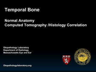 Temporal Bone
Normal Anatomy
Computed Tomography /Histology Correlation
Otopathology Laboratory
Department of Radiology
Massachusetts Eye and Ear
Otopathologylaboratory.org
 