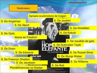 Marcial Medina Médico Escolar S. De Angelman Síndromes: S. De Alport S. De Opitz Ataxia de Friedrich S. De Down S. De Edwards S. De Freeman Sheldon S. De Jacobsen Apraxia oculomotora de Cogan S. De Joubert S. De Klinefelter S. De Kabuki S. De maullido de gato S. De Rubinstein Taybi S. De Russel Silver S. De Sturge Weber S. De Williams S. De Rett Plurideficiencias no filiadas 