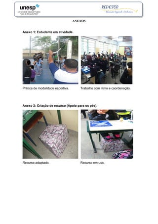 ANEXOS
Anexo 1: Estudante em atividade.
Prática de modalidade esportiva. Trabalho com ritmo e coordenação.
Anexo 2: Criação de recurso (Apoio para os pés).
Recurso adaptado. Recurso em uso.
 