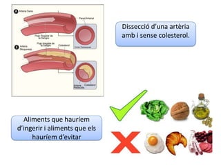 Aliments que hauríem
d’ingerir i aliments que els
hauríem d’evitar
Dissecció d’una artèria
amb i sense colesterol.
 