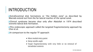 Extraforaminal PELD | PPT