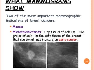 WHAT MAMMOGRAMS
SHOW
Two of the most important mammographic
indicators of breat cancers
Masses
Microcalcifications: Tiny flecks of calcium – like
grains of salt – in the soft tissue of the breast
that can sometimes indicate an early cancer.
42
 