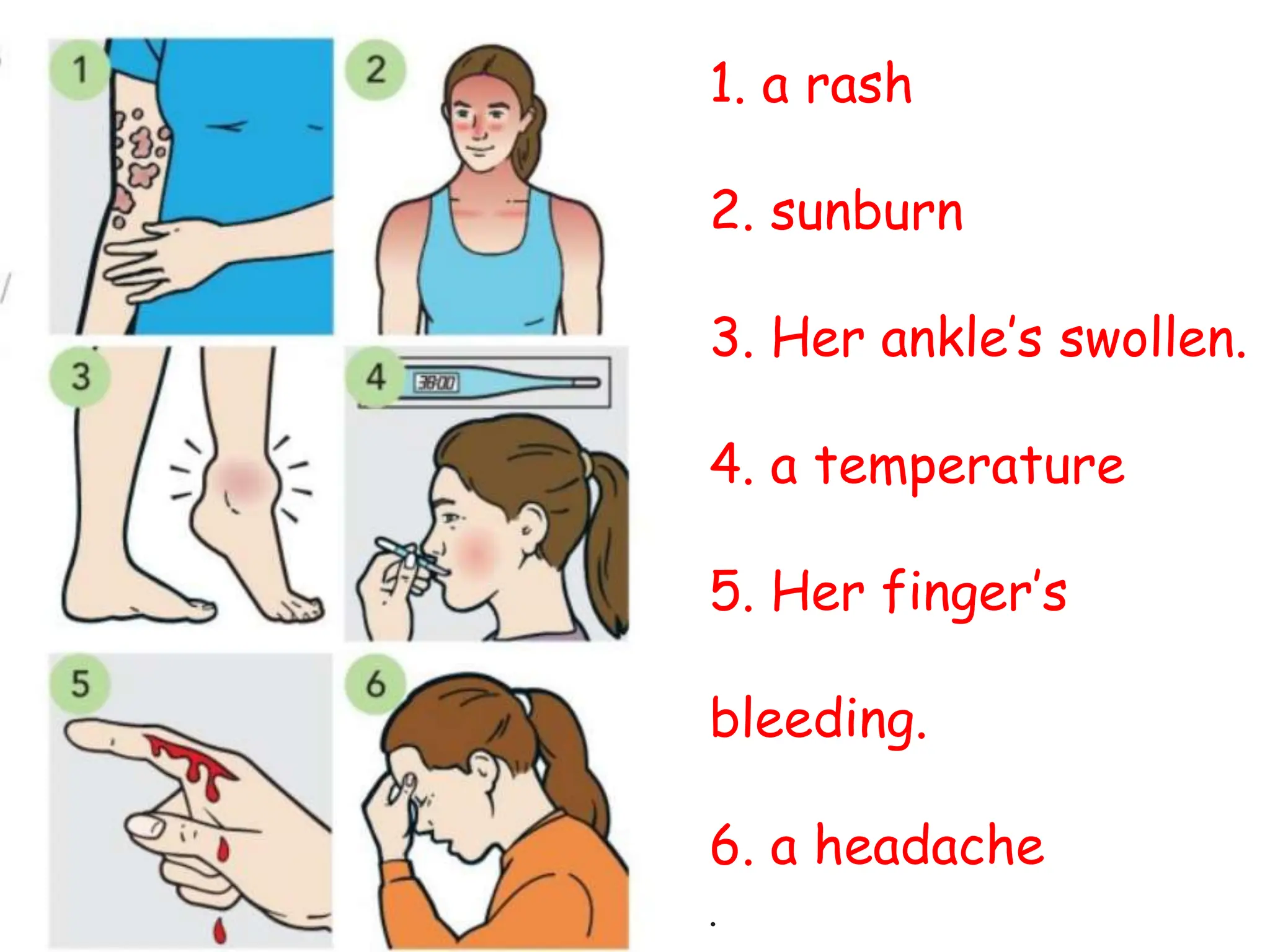 1. a rash
2. sunburn
3. Her ankle’s swollen.
4. a temperature
5. Her finger’s
bleeding.
6. a headache
.
 