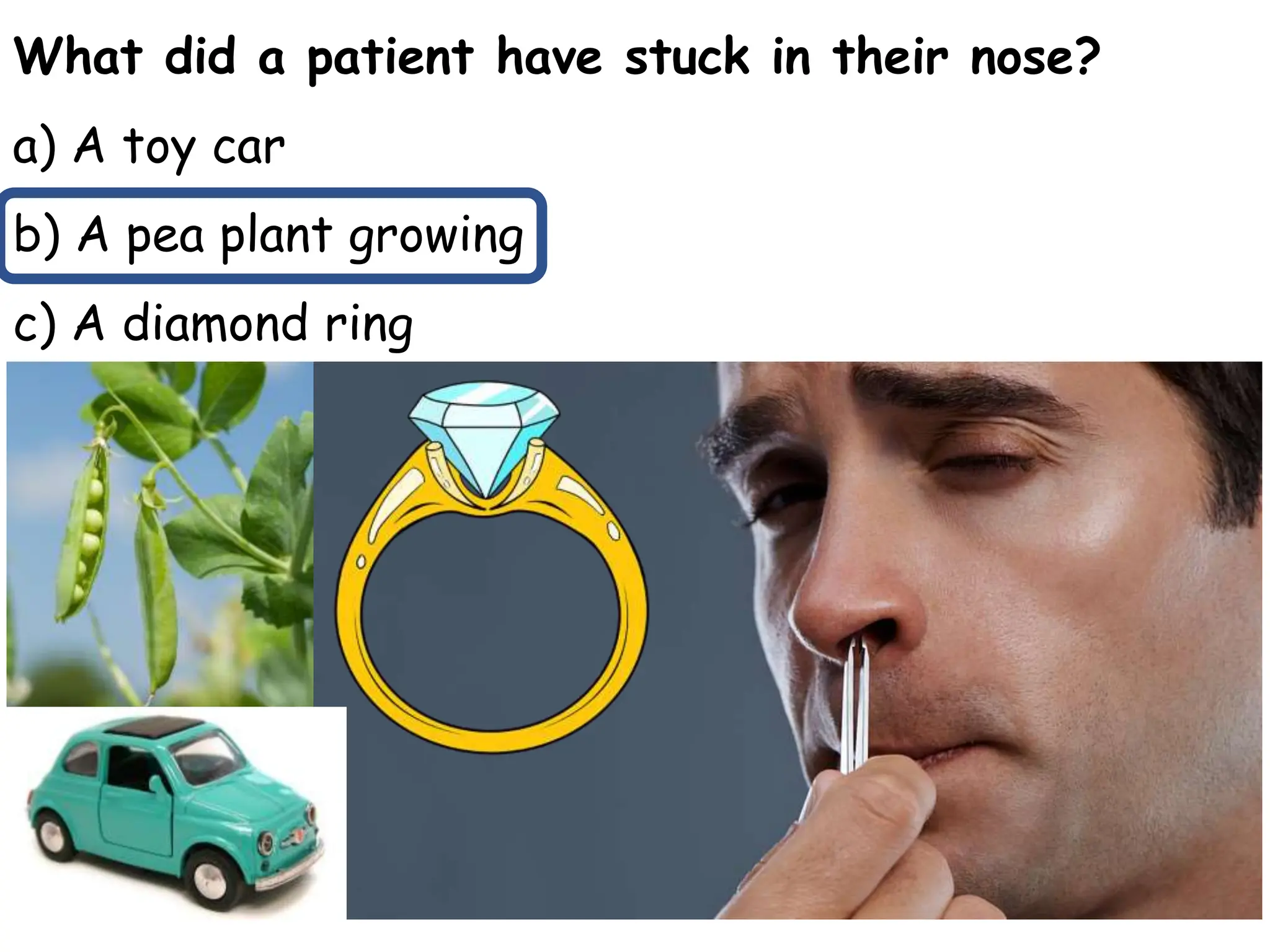 What did a patient have stuck in their nose?
a) A toy car
b) A pea plant growing
c) A diamond ring
 