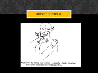 ROTACION LATERAL
 