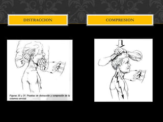 DISTRACCION COMPRESION
 