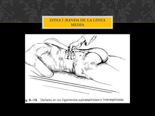 ZONA I :BANDA DE LA LINEA
MEDIA
 