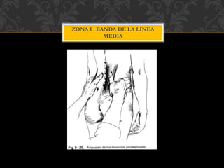 ZONA I : BANDA DE LA LINEA
MEDIA
 