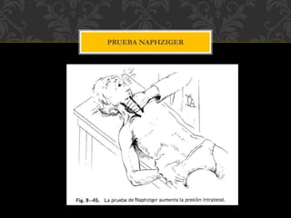 PRUEBA NAPHZIGER
 