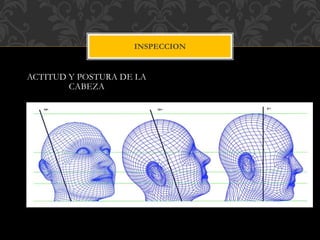 ACTITUD Y POSTURA DE LA
CABEZA
INSPECCION
 