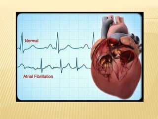 Efectele curentului electric asupra corpului uman