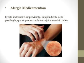 • Alergia Medicamentosa
Efecto indeseable, imprevisible, independiente de la
posología, que se produce solo en sujetos sensibilizados.
 