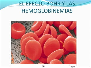 EL EFECTO BOHR Y LAS
HEMOGLOBINEMIAS
 