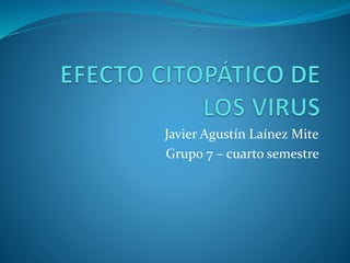 Javier Agustín Laínez Mite
Grupo 7 – cuarto semestre
 