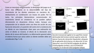 Como se mencionó anteriormente, la dimensión del juego es el
factor más influyente en la determinación del tipo de
movimiento de los dientes anteriores en mecánica de
deslizamiento en combinación con brazos de poder. Por lo
tanto, los principios biomecánicos convencionales de
movimiento dental en ortodoncia no se pueden aplicar
directamente en situaciones clínicas reales. Aunque una
comprensión de la relación entre una línea de acción de una
fuerza de retracción y la posición del centro de la resistencia de
un diente es una importante clave para una estimación de
cómo el diente se moverá, el efecto de la desviación arco
dentro de la ranura del bracket y su deformación general sobre
el sistema fuerza que actúa sobre un diente también debe ser
considerado (Figs 7 y 8).
Sección transversal sagital en la superficie mesial
del bracket del incisivo central superior antes de
ejercer fuerza de retracción (izquierda) y después
de la aplicación de la fuerza a la altura de 12 mm
(derecha): arco 0.017x0.022 pulgadas de slot de
0,018 pulgadas (arriba) y arco 0.019x0.025
pulgadas en el slot de 0,022 pulgadas (abajo).
 