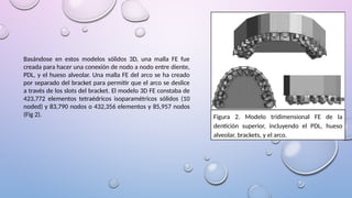 Basándose en estos modelos sólidos 3D, una malla FE fue
creada para hacer una conexión de nodo a nodo entre diente,
PDL, y el hueso alveolar. Una malla FE del arco se ha creado
por separado del bracket para permitir que el arco se deslice
a través de los slots del bracket. El modelo 3D FE constaba de
423,772 elementos tetraédricos isoparamétricos sólidos (10
noded) y 83,790 nodos o 432,356 elementos y 85,957 nodos
(Fig 2). Figura 2. Modelo tridimensional FE de la
dentición superior, incluyendo el PDL, hueso
alveolar, brackets, y el arco.
 