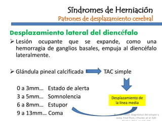 Desplazamiento lateral del diencéfalo
 Lesión ocupante que se expande, como una
hemorragia de ganglios basales, empuja al diencéfalo
lateralmente.
 Glándula pineal calcificada TAC simple
0 a 3mm… Estado de alerta
3 a 5mm… Somnolencia
6 a 8mm… Estupor
9 a 13mm… Coma
Síndromes de Herniación
Patrones de desplazamiento cerebral
Desplazamiento de
la línea media
Plum & Posner. Diagnóstico del estupor y
coma. Fred Plum, J Posner, et al. Edit.
 