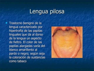 Lengua pilosa Trastorno benigno de la lengua caracterizado por hipertrofia de las papilas linguales que da al dorso de la lengua un aspecto de fieltro. El color de las papilas alargadas varía del blanco amarillento al pardo o negro, según seja la coloración de sustancias como tabaco  