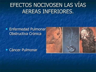 EFECTOS NOCIVOSEN LAS VÍAS AEREAS INFERIORES. Enfermedad Pulmonar Obstructiva Crónica Cáncer Pulmonar 