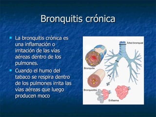 Bronquitis crónica La bronquitis crónica es una inflamación o irritación de las vías aéreas dentro de los pulmones.  Cuando el humo del tabaco se respira dentro de los pulmones irrita las vías aéreas que luego producen moco  