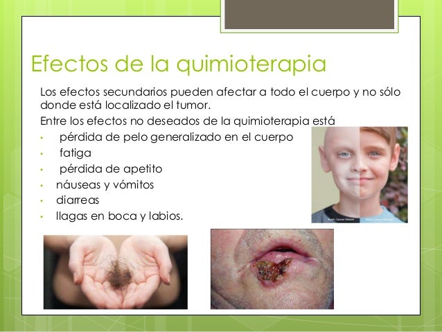 Ultrasonoro lifting las personas en ufe el precio