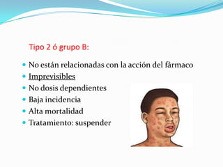 Tipo 2 ó grupo B:
 No están relacionadas con la acción del fármaco
 Imprevisibles
 No dosis dependientes
 Baja incidencia
 Alta mortalidad
 Tratamiento: suspender
 
