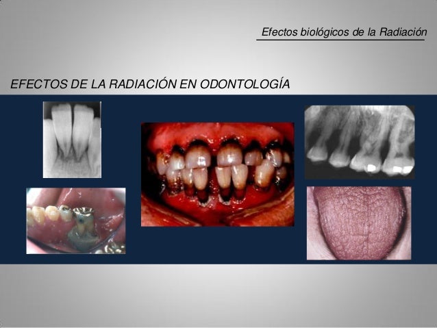 Efectos Biologicos De La Radiacion En Odontologia